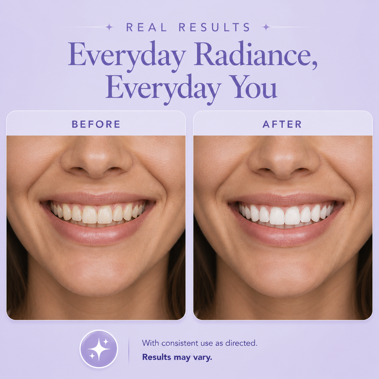 Before and after teeth whitening results showing a real man’s smile with visibly brighter, whiter teeth after treatment on a soft lavender background.