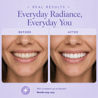 Before and after teeth whitening results showing a real man’s smile with visibly brighter, whiter teeth after treatment on a soft lavender background.