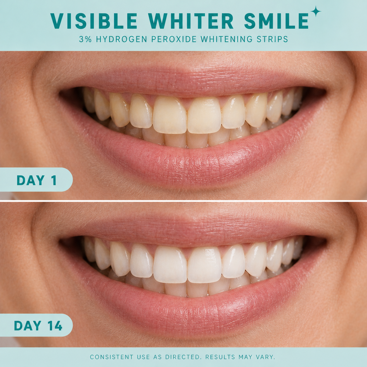Before-and-after comparison of a real human smile showing visible teeth whitening results from day 1 to day 14 using 3% hydrogen peroxide whitening strips, with noticeably brighter and whiter teeth in the after image.