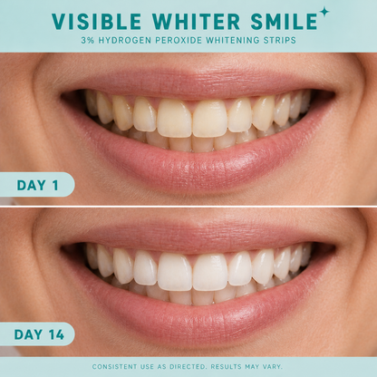 Before-and-after comparison of a real human smile showing visible teeth whitening results from day 1 to day 14 using 3% hydrogen peroxide whitening strips, with noticeably brighter and whiter teeth in the after image.