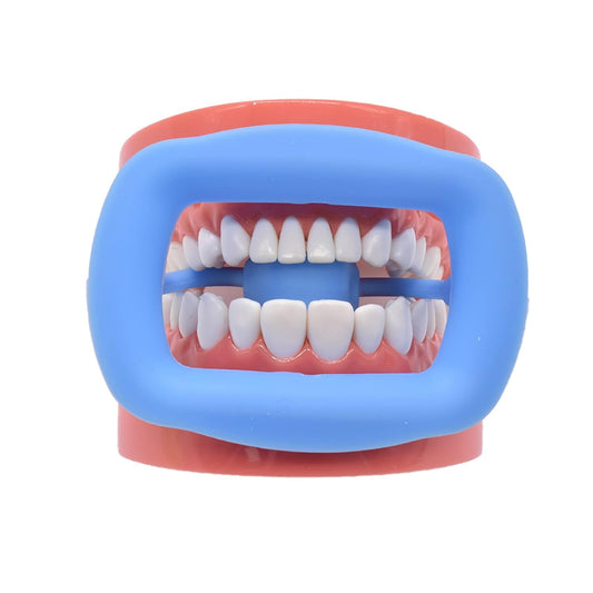 Blue medium silicon cheek retractor placed in mouth showing teeth