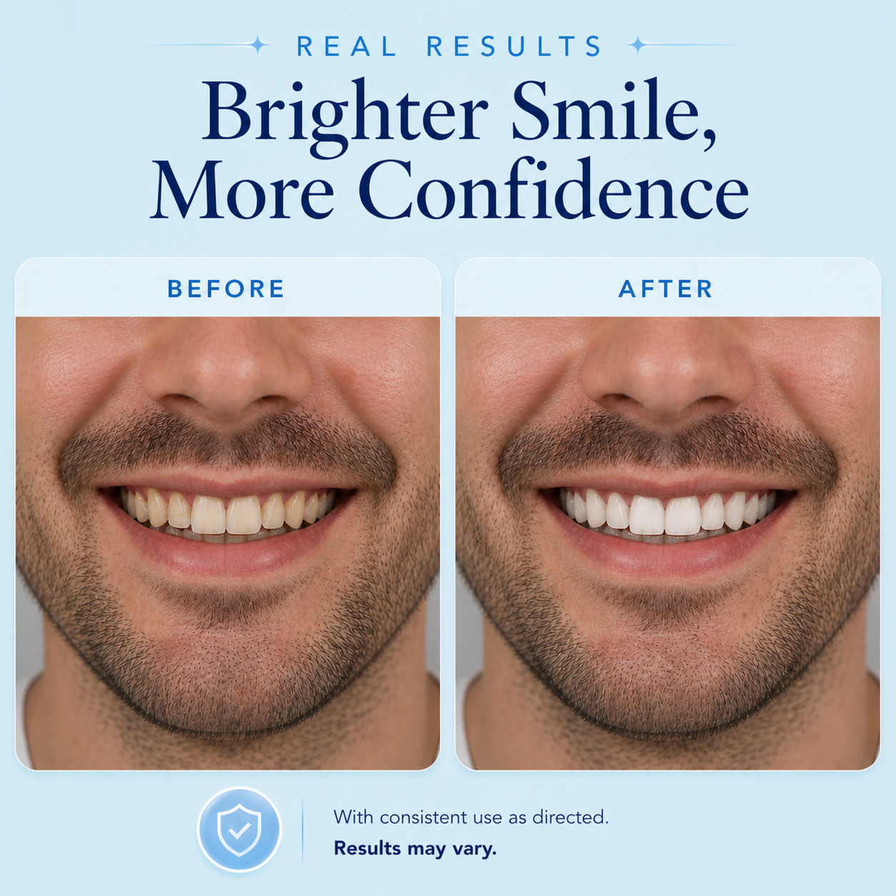 Before and after teeth whitening results showing a real man’s smile with visibly brighter, whiter teeth after treatment on a soft blue background.
