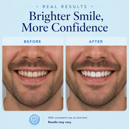 Before and after teeth whitening results showing a real man’s smile with visibly brighter, whiter teeth after treatment on a soft blue background.