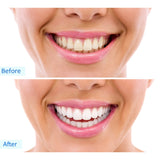Teeth Whitening Before / After - TheWhiteningStore.com