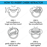How to Insert Cheek Retractor - The Whitening Store - Teeth Whitening Supplies and Dental Products